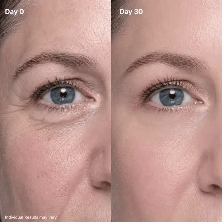 🔥Eye Renewal Cream
