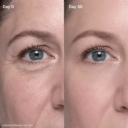 🔥Eye Renewal Cream